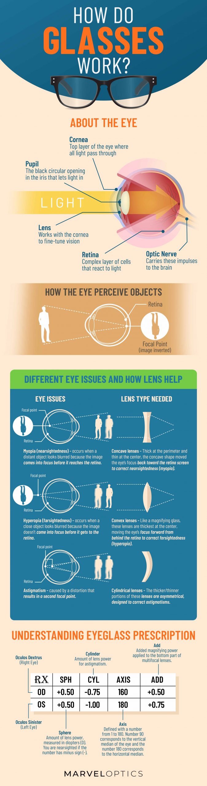 How do cheap nearsighted glasses work